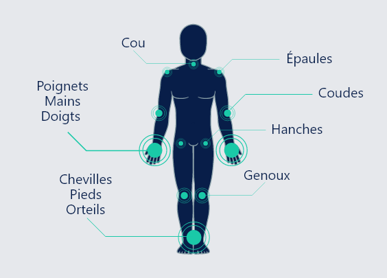 polyarthrite rhumatoïde