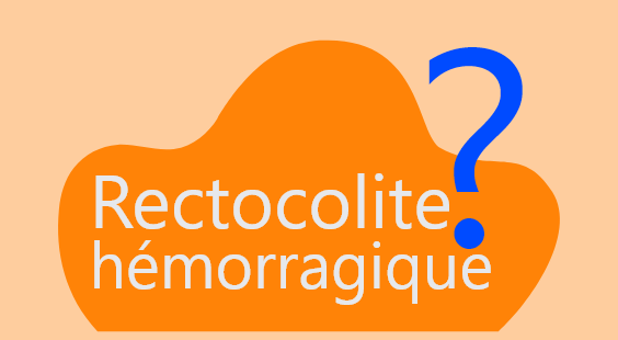 Testez vos connaissances sur la rectocolite hémorragique 