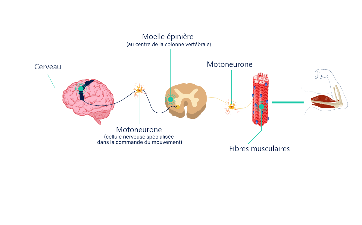 Comprendre La Spasticit AbbVie Care