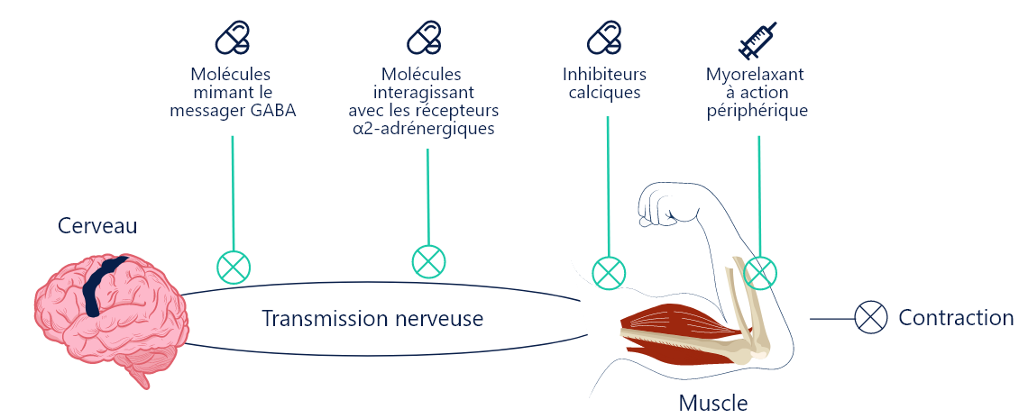 Image d’un schéma illustrant le mode d’action des thérapies médicamenteuses